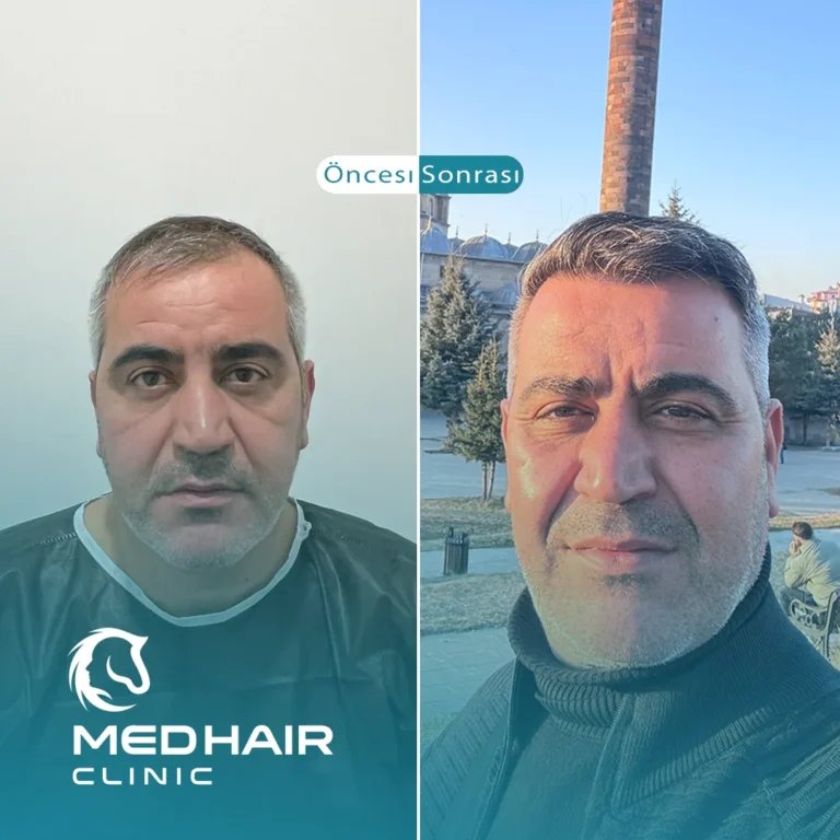 3.png-adli-dosyanin-kopyasi_2026-1