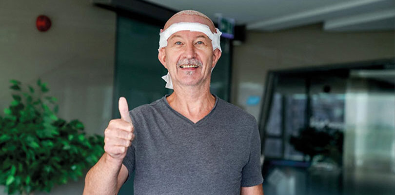 Homme souriant levant le pouce après une greffe de cheveux, portant un bandeau de protection autour de la tête.