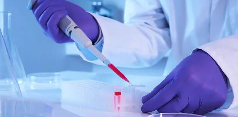 Chercheur en blouse blanche et gants violets utilisant une micropipette pour transférer un échantillon rouge dans un tube, lors d'un traitement par cellules souches capillaires en laboratoire
