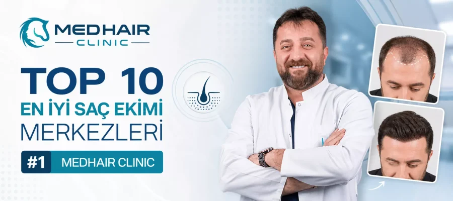TOP 10 En İyi Saç Ekimi Merkezleri