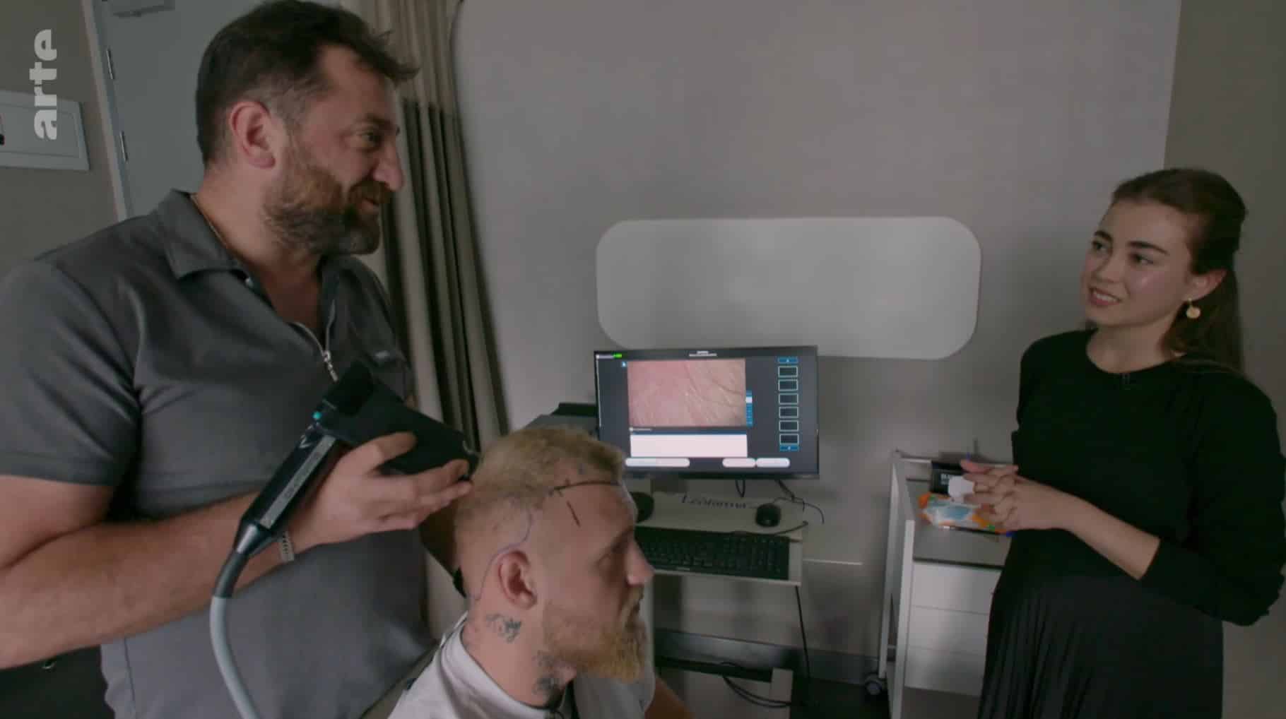 ARTE – MedHair Clinic Haartransplantation Türkei