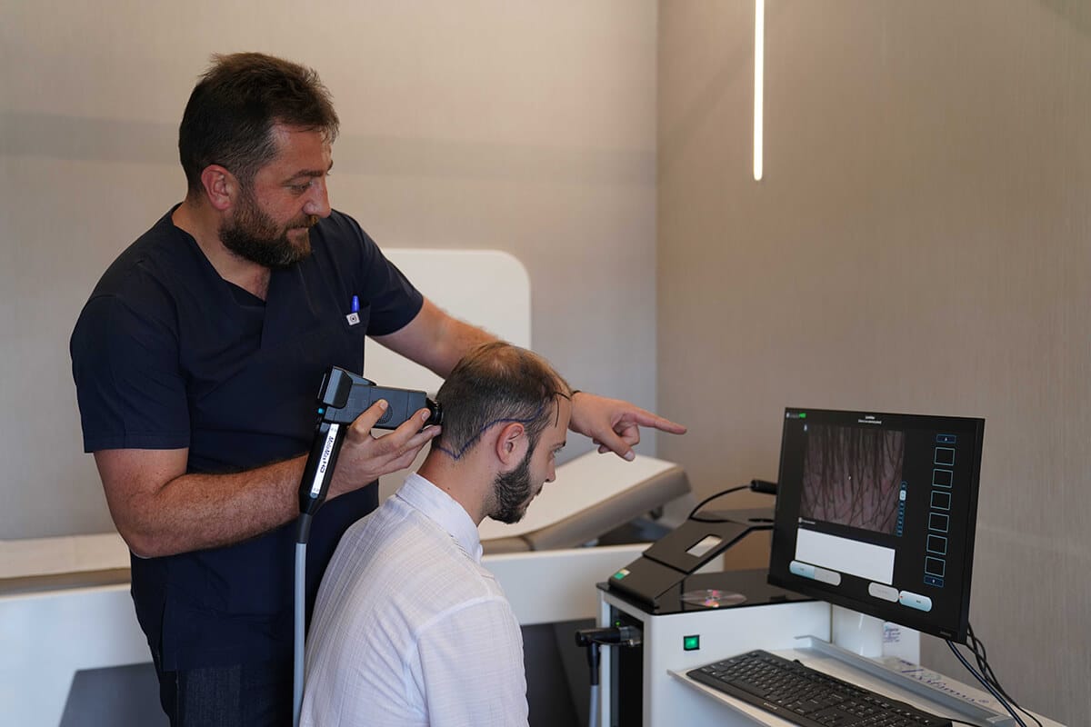 Beste Haartransplantation Türkei – Haaranalyse durch Dr. Vedat Tosun von der MedHair Clinic