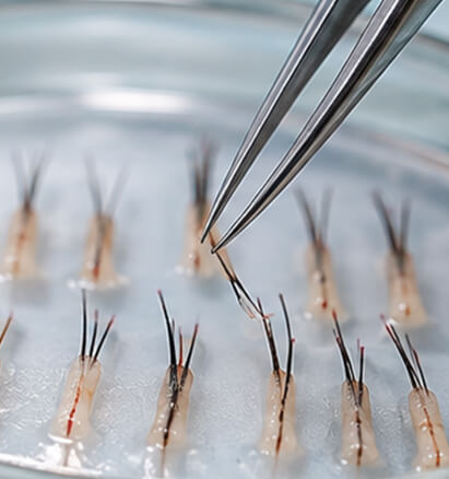 Vorbereitung der Grafts